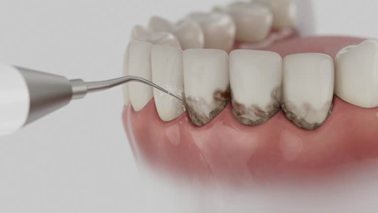 Trusted Teeth Cleaning And Checkup service in Carson, WA - Dentist Open Now
